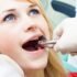 How to prepare for wisdom teeth removal