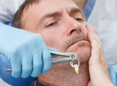 Day-by-Day Tooth Extraction Healing Stages with Pictures: Your Visual Guide to Normal Recovery 2026