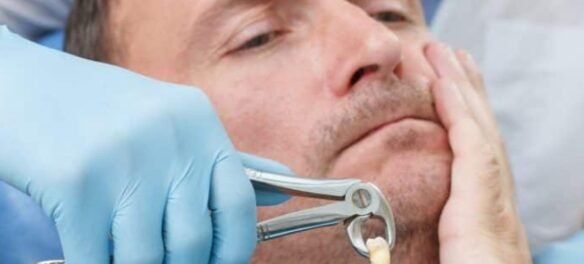 day by day tooth extraction healing stages