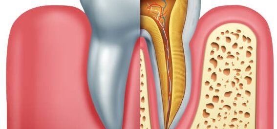 tooth with root canal hurts with pressure