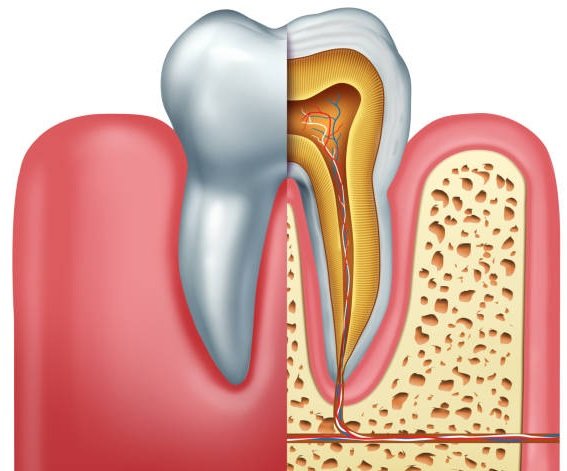 tooth with root canal hurts with pressure