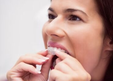 Can You Chew Gum With Invisalign