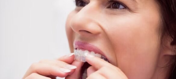 Can You Chew Gum With Invisalign