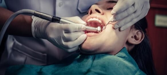 How Long Should a Tooth Hurt After a Filling