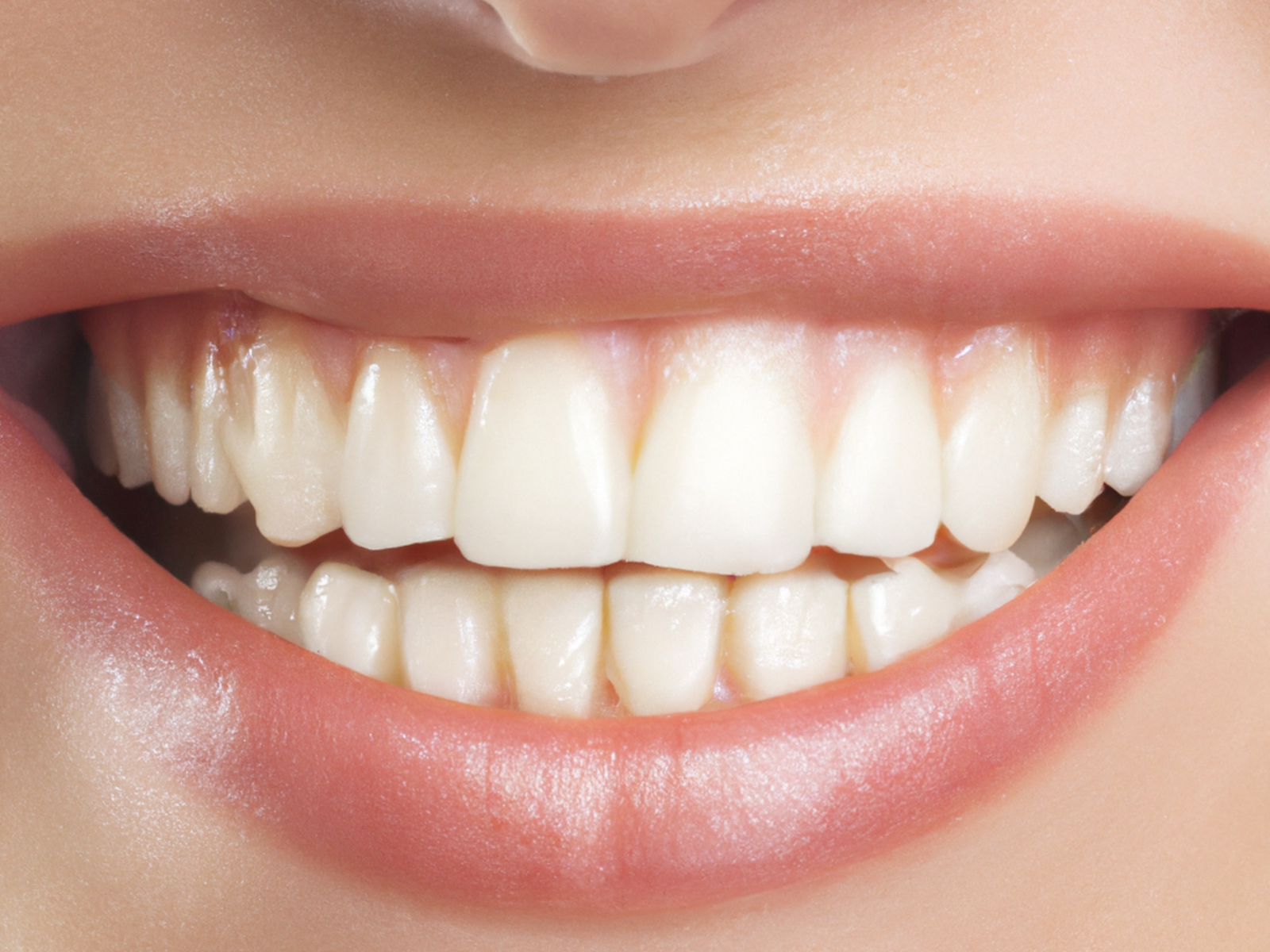 Teeth Scaling Before And After