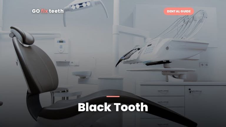 Black Tooth: Causes, What It Means & Treatment Costs