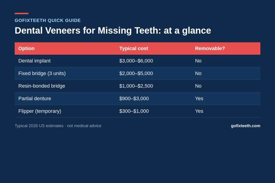 Dental Veneers for Missing Teeth at a glance