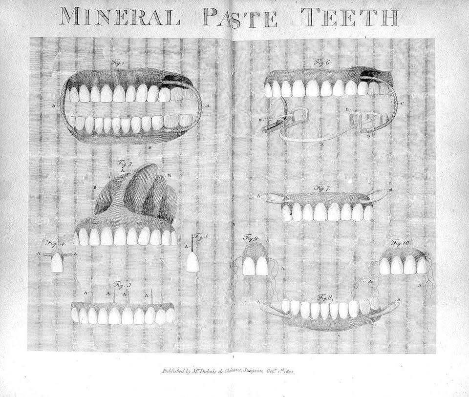 Antique sheet of porcelain denture teeth; dentures have been around far longer than implants