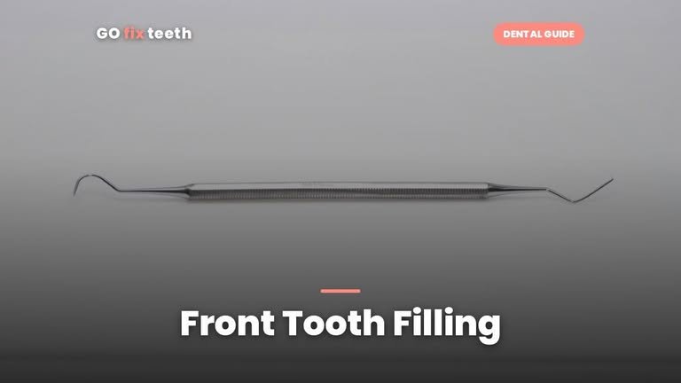 Front Tooth Filling: Look, Lifespan and Cost (2026)