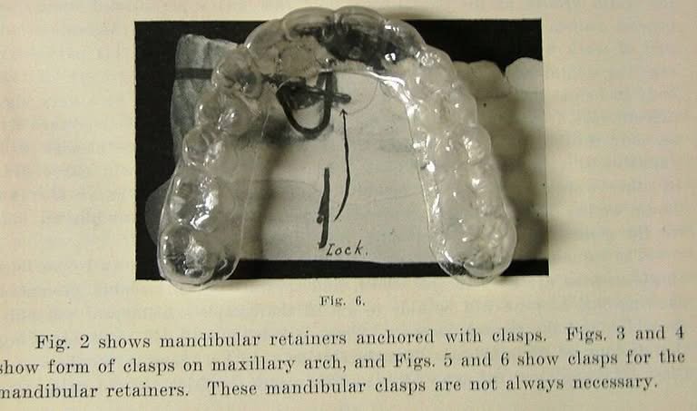 Clear orthodontic retainers that can be cleaned with an ultrasonic cleaner