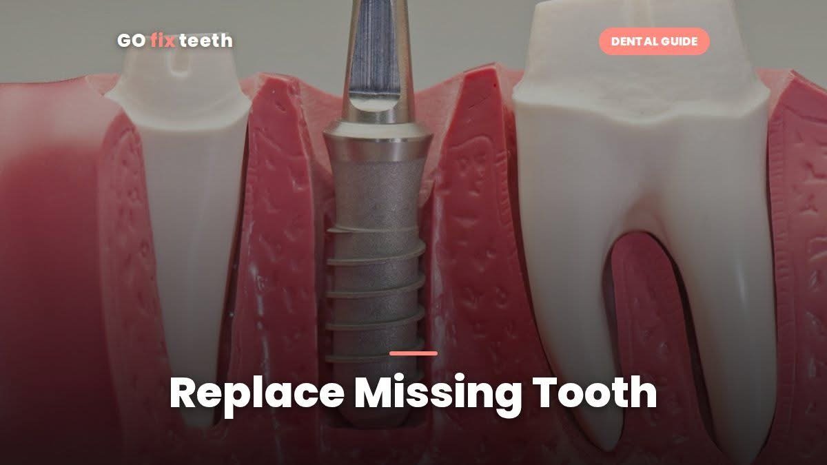 Replace Missing Tooth: Implant vs Bridge vs Denture