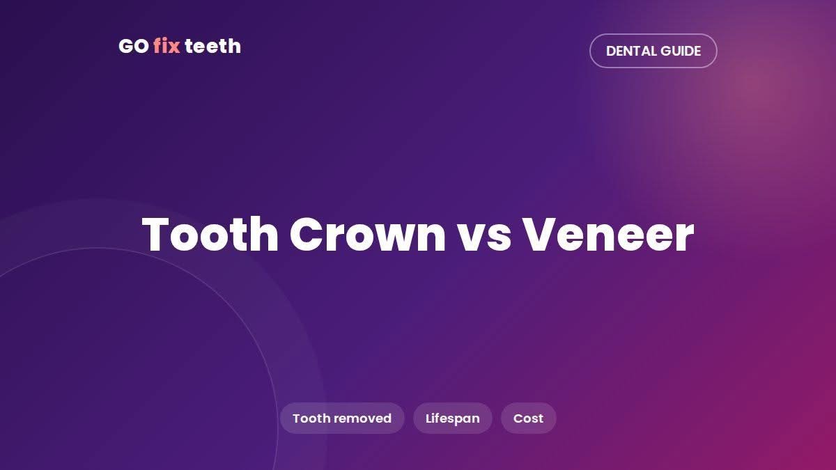 Tooth Crown vs Veneer: Differences, Cost and Lifespan